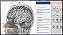 Analisador de Biorressonância NLS Hunter 4025 BA18G - Imagem 9
