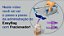 Fracionador Fresenius Easybag - Imagem 2