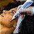 Hygiaplasma Kld - Aparelho De Jato De Plasma - Imagem 5