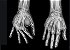 Rx da Mão (unilateral) - Imagem 1