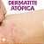 Composto Dermatite Atópica : Pool Lactobacillus 120 Cápsulas - Imagem 2