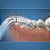 Bico ortodôntico com 02 unidades para irrigador oral Aquajet FC168 - Imagem 3