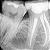 Sensor Intraoral Rayin Tamanho 1.0 Woson | 25 Lp/mm | Área Ativa 20x30mm - Imagem 2