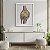 Quadro Decorativo Medicina Anatomia do Joelho Humano Fisioterapia Ortopedia - Imagem 2