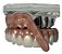 Manequins Modelos Odontológicos Protocolo 6 Implantes e Overdenture Barra Clipe 2 Implantes - Imagem 2