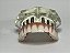 Manequins Modelos Odontológicos Protocolo 6 Implantes e Overdenture Barra Clipe 2 Implantes - Imagem 7
