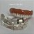 Manequins Modelos Odontológicos Protocolo 6 Implantes e Overdenture Barra Clipe 2 Implantes - Imagem 9