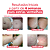 Cicatrissim Red Creme para Estrias Vermelhas + CicatrissimCaps 1 unidade - Imagem 4