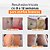 Creme para estrias - CicatriSSim 2 unidades - Imagem 2