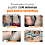 Cicatrissim + ByeByeBumps 1 unidade - Imagem 2