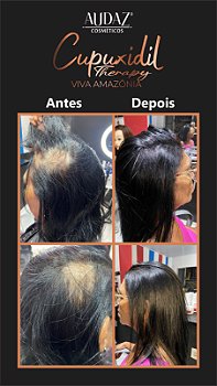 Shampoo 500ml Cupuxidil Therapy