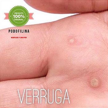 Podofilina 25% Tratamento Anti Verrugas - 15 ml