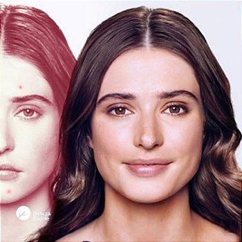 Gel Peróxido De Benzoila 10% : Cravos, Espinhas, Acne 90gr