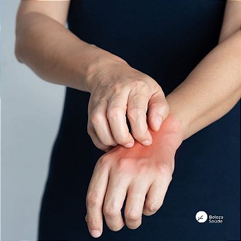 Spray Anti-fungos : Cetoconazol + Ciclopirox Olamina 50ml