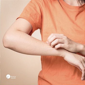 Creme Hidratante para Eczema e Dermatite : 100gr