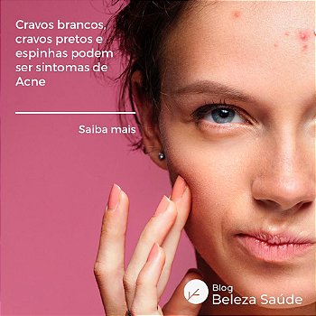 Fórmula Oral para Tratamento da Acne