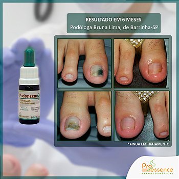 Podoneem - Restaurador de Unhas 10ml