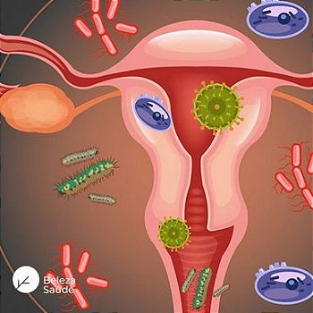 Lactobacillus Crispatus + Lactobacillus Acidophilus + Lactobacillus Reuteri : Probióticos para Saúde Vaginal - 120 doses