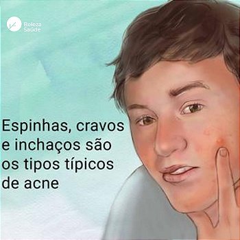 Composto Max Anti Acne, Comedões, Espinha, Cravo : 175 Caps
