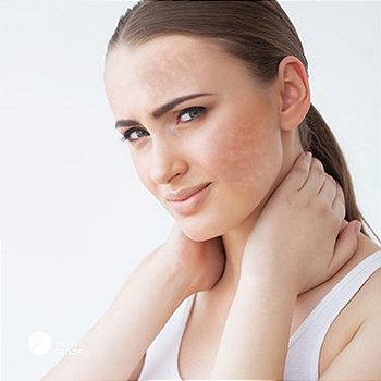 Niacinamida, Zinco, Belides, Arbutin : Melasma Mancha 75gr