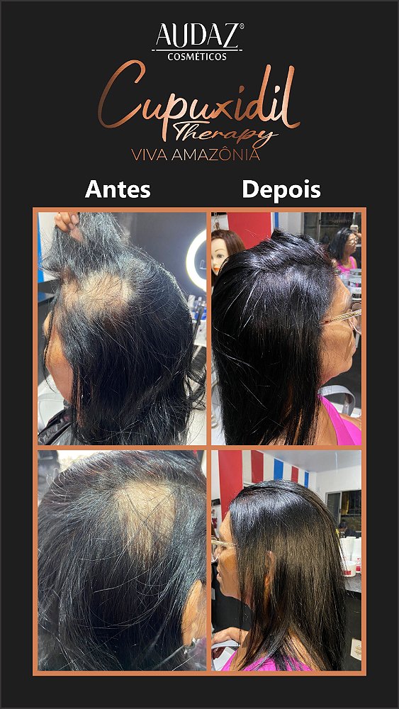 Shampoo 500ml + Máscara 500ml Cupuxidil Therapy