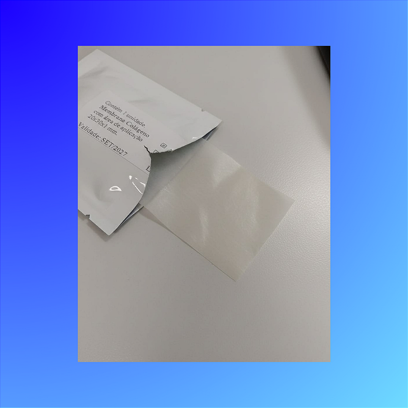 Membrana de Colágeno Absorvível – Uso Odontológico | 20x30x1mm