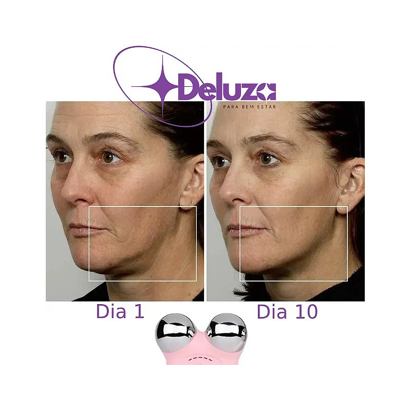 Micro Lift Massageador Facial Microcorrente Lifting Do Rosto