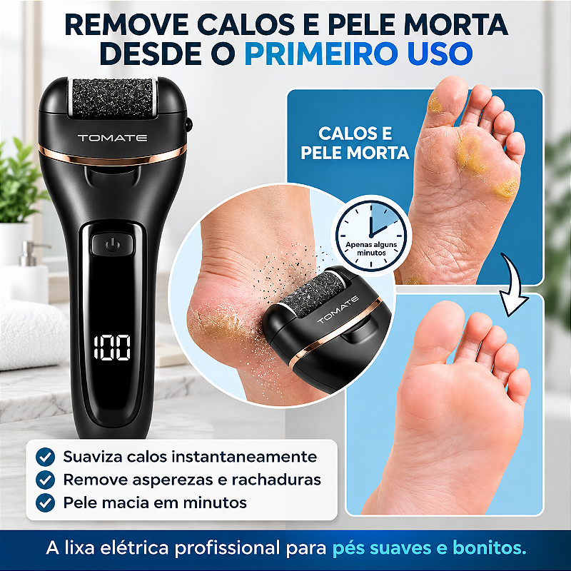 Lixa Elétrica Para Pés Recarregável Usb Removedor De Calos MAG-043 TOMATE