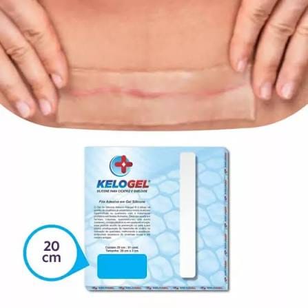 Fita Gel De Silicone P/ Cicatriz E Queloide 20x3cm Kelogel