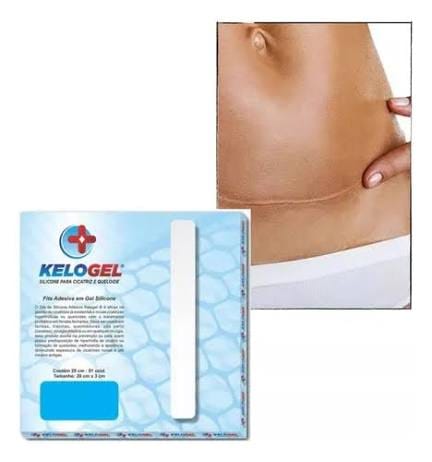 Fita Gel De Silicone P/ Cicatriz E Queloide 20x3cm Kelogel