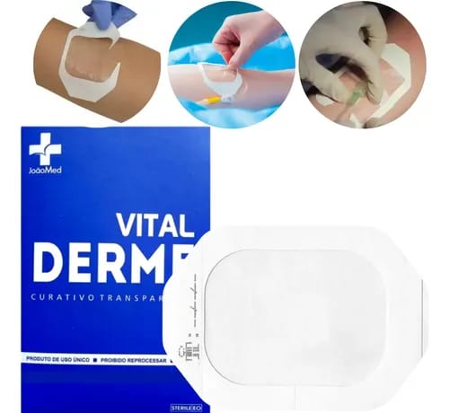 50un Curativo Transparente Estéril Vitalderme 6 X 7cm