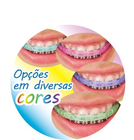 PRÓ-LIP PROTETOR BUCAL EM SILICONE PARA APARELHO FIXO - Pró-lip ...
