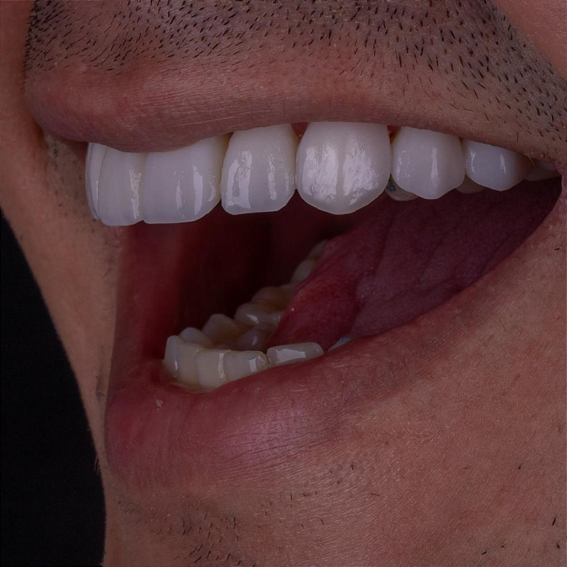 Resina 3d Smart Print Bio Vitality 04 Cn82h55y37