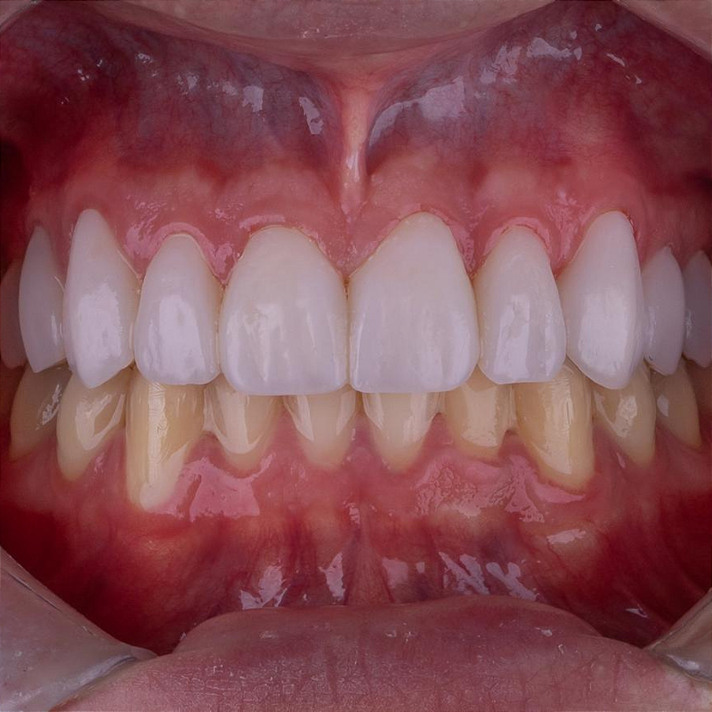 Resina 3d Smart Print Bio Vitality 05 B6te0922wq