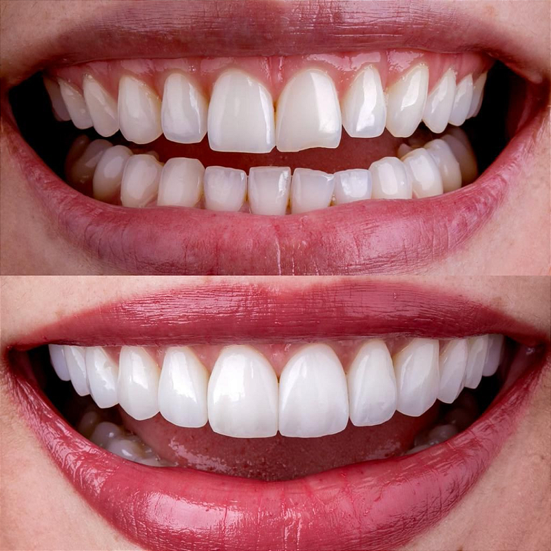 Resina 3d Smart Print Bio Vitality 06 Q3jvd7xx1d