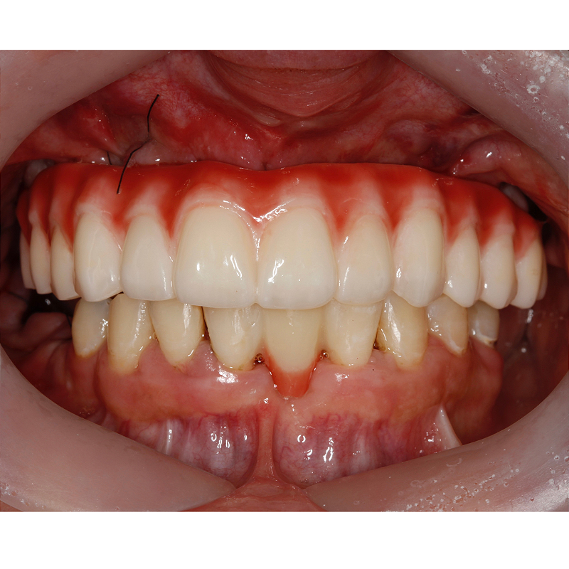 Resina 3d Smart Print Bio Vitality 17 Jvhhpa1ow2