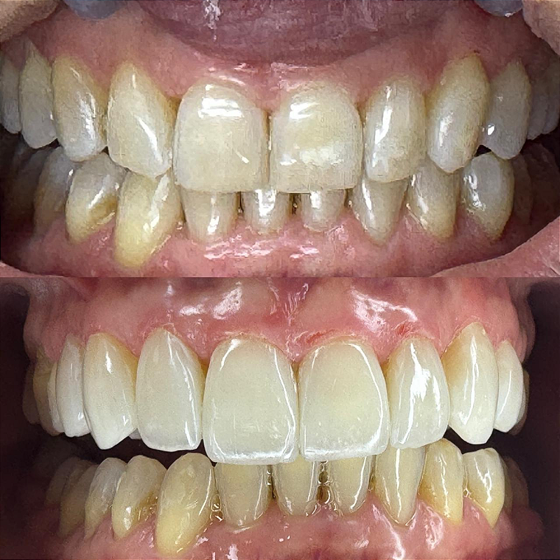 Resina 3d Smart Print Bio Vitality 20 Y2y2f179nc