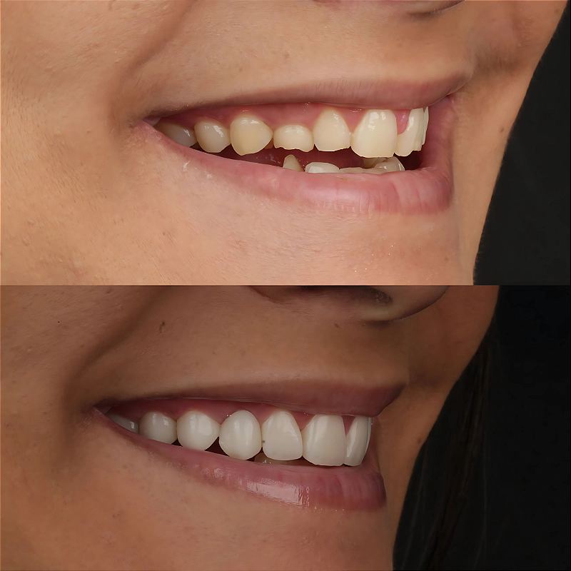 Resina 3d Smart Print Bio Vitality 29 E14zkzpit6