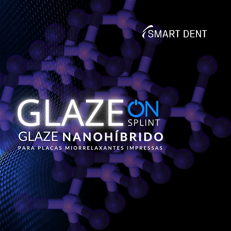 Glaze Flex Feed 2 Ord0bk0a35