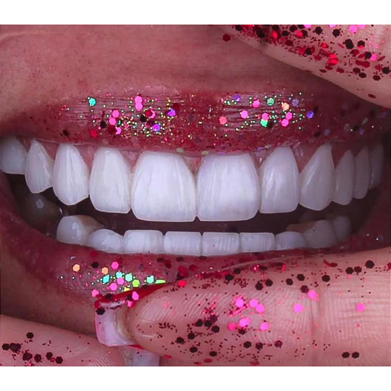 Atos Resina Composta Direta 12 3klq548qd0