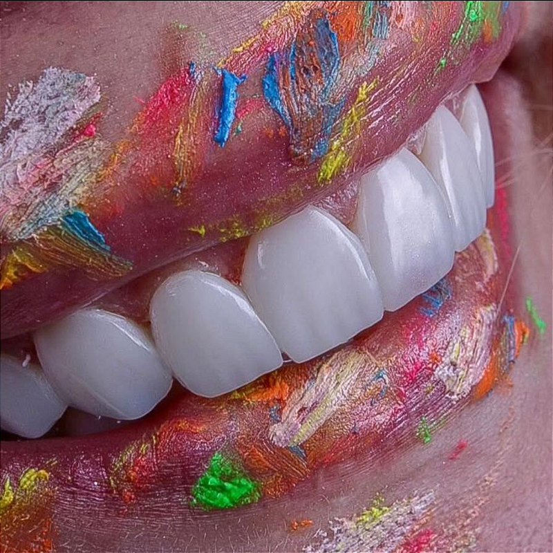 Atos Resina Composta Direta 10 Xcvp1sjyd8