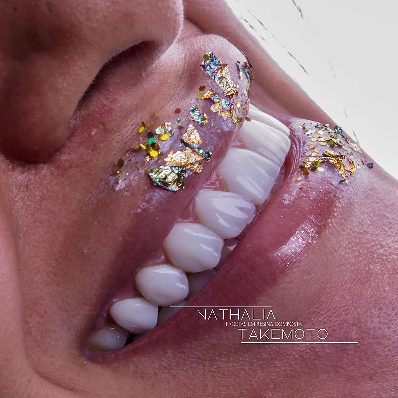 Atos Resina Composta Direta 03 X6zcnio72y