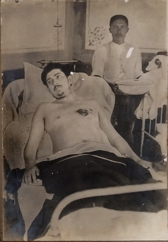 Rara Fotografia Antiga de Falecido com Ferimento a Bala, em Maca Hospitalar