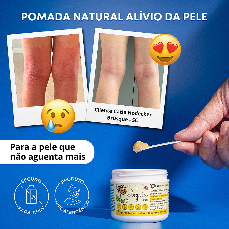 Pomada Alívio da Pele ALEGRIA | 50g