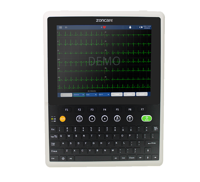 Eletrocardiógrafo IMAC 120 PRO com DICOM- ZONCARE - Loja Bio Infinity