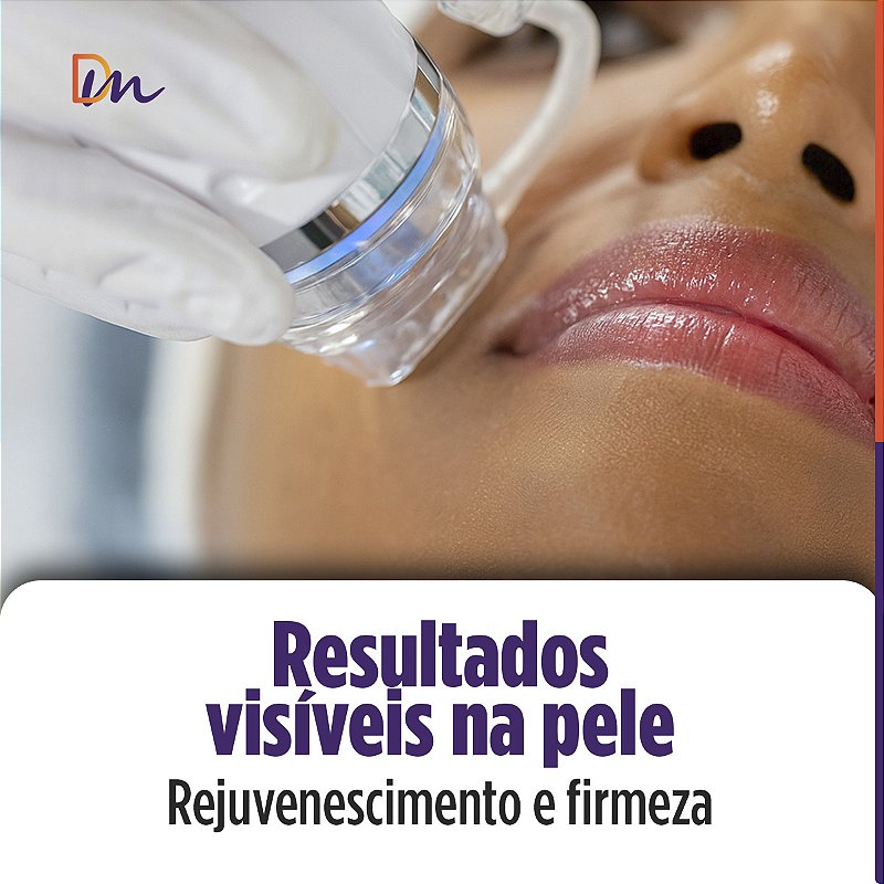 Needle RF Equipamento de Radiofrequência Microagulhada - HTM