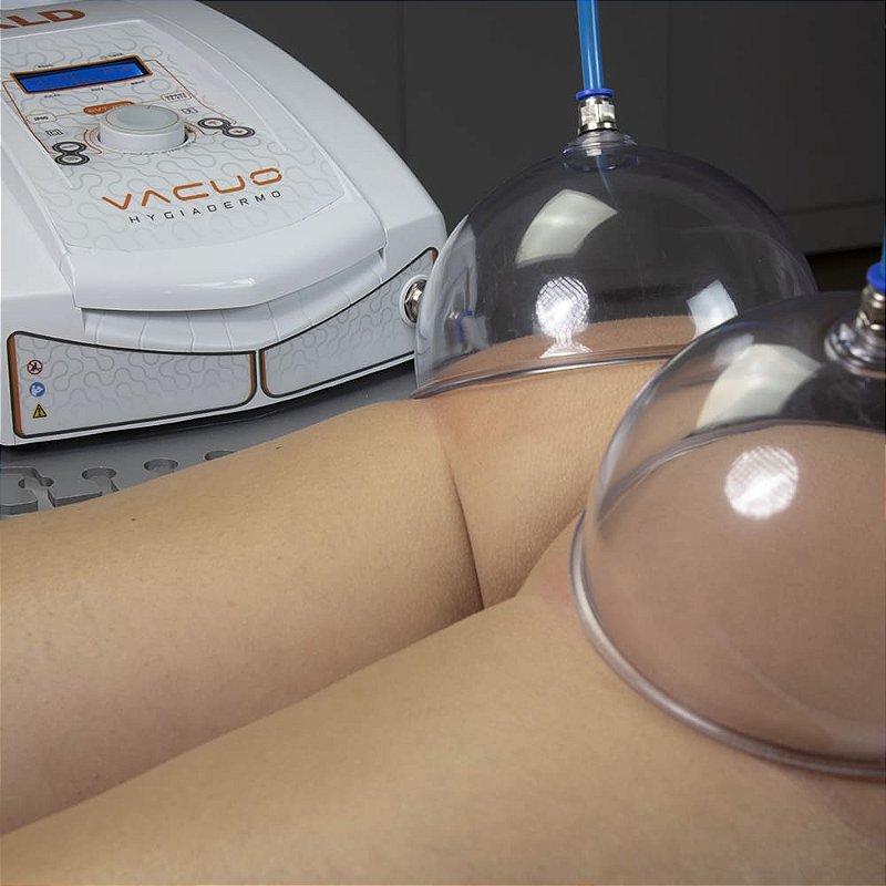 Aparelho Hygiadermo Vácuo Vacuoterapia, Endermologia e Peeling Mecânico - KLD Biossistemas
