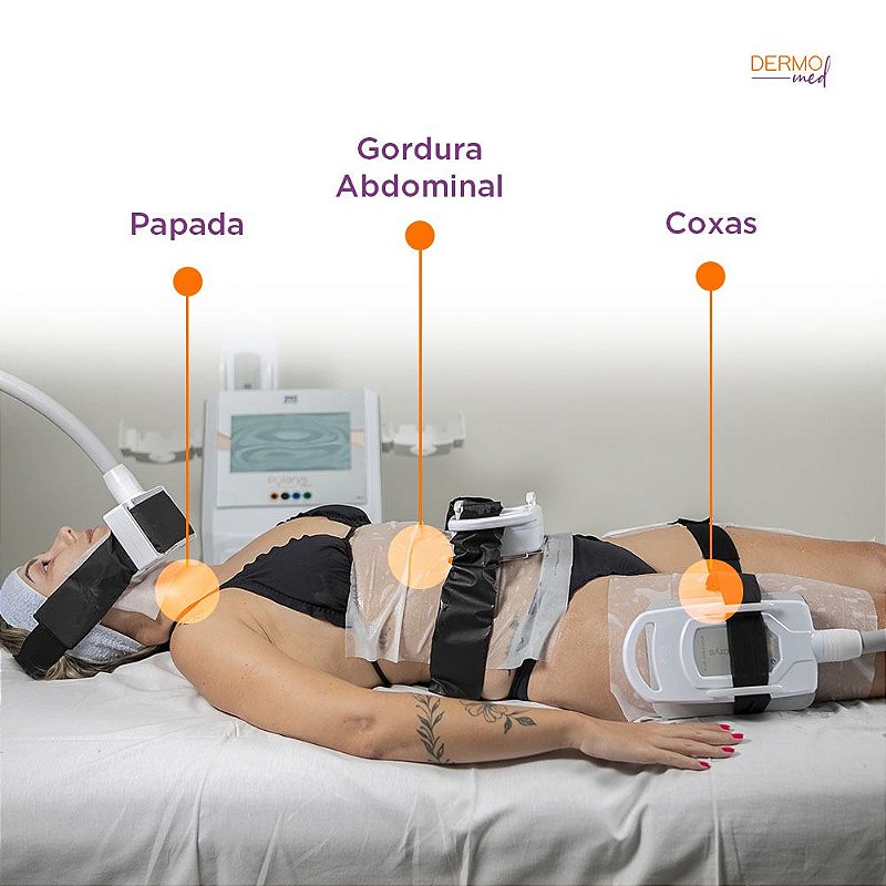 Aplicador Intercambiável Polarys Plaxx - Ibramed