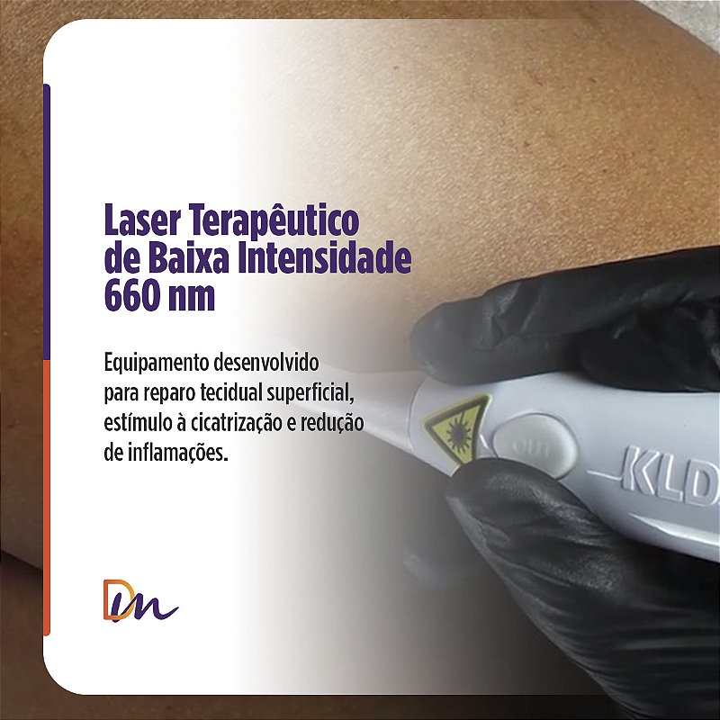 Endophoton Lite 660 Laser De Baixa Intensidade Sem Fio - KLD Biossistemas
