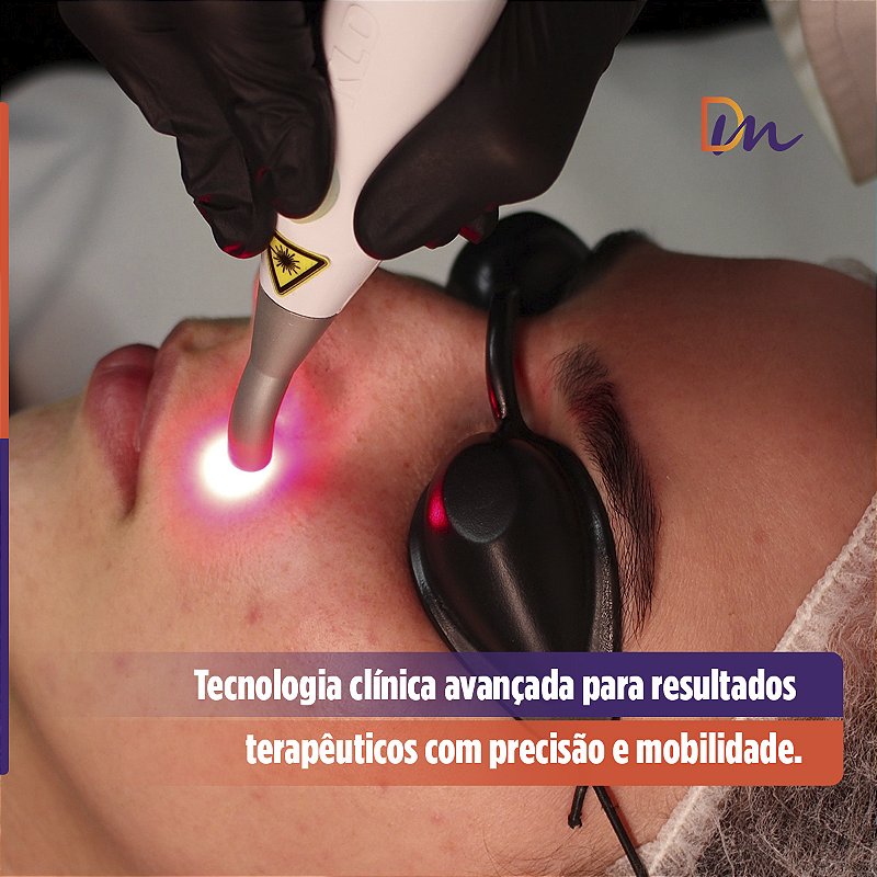 Endophoton Lite 660 Laser De Baixa Intensidade Sem Fio - KLD Biossistemas